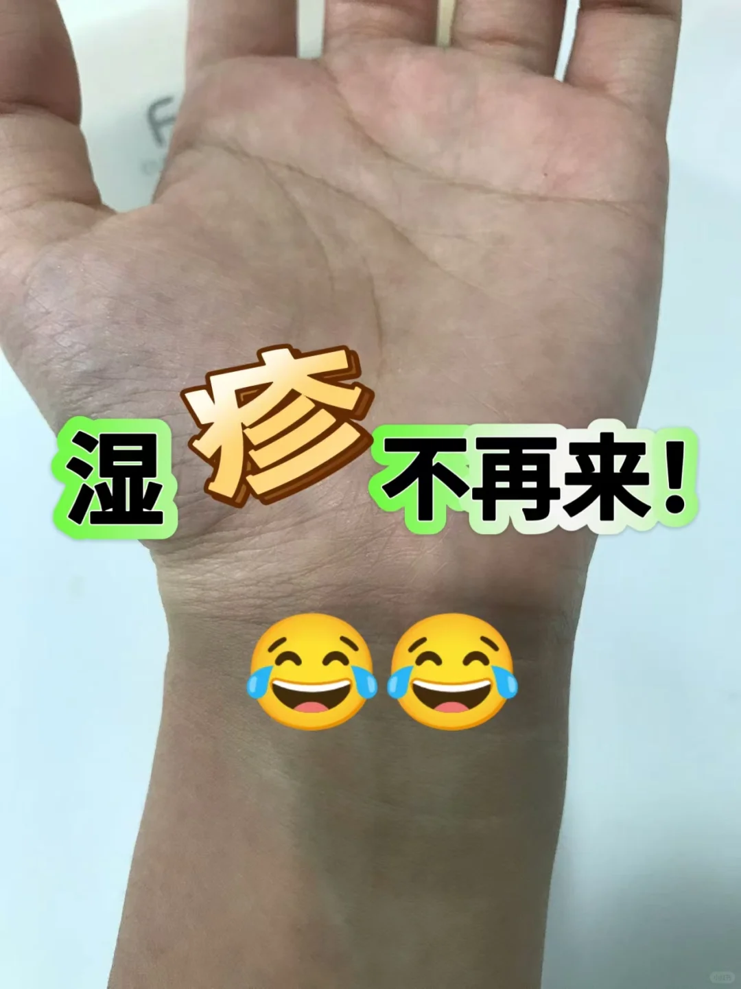 手臂湿疹不在🤣我的信心又回来了！