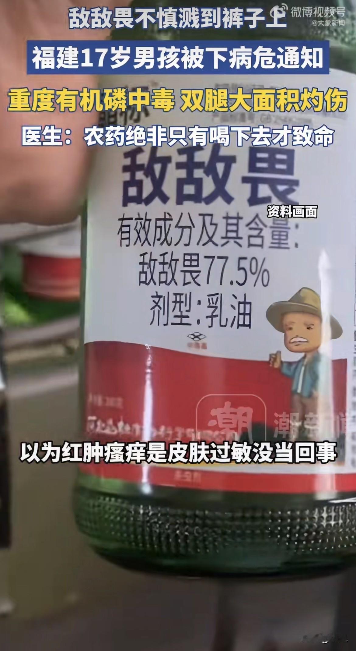 一个大小伙子，腿上糊了半小时敌敌畏，愣是没觉得不对劲。

不是他迟钝。敌敌畏这玩