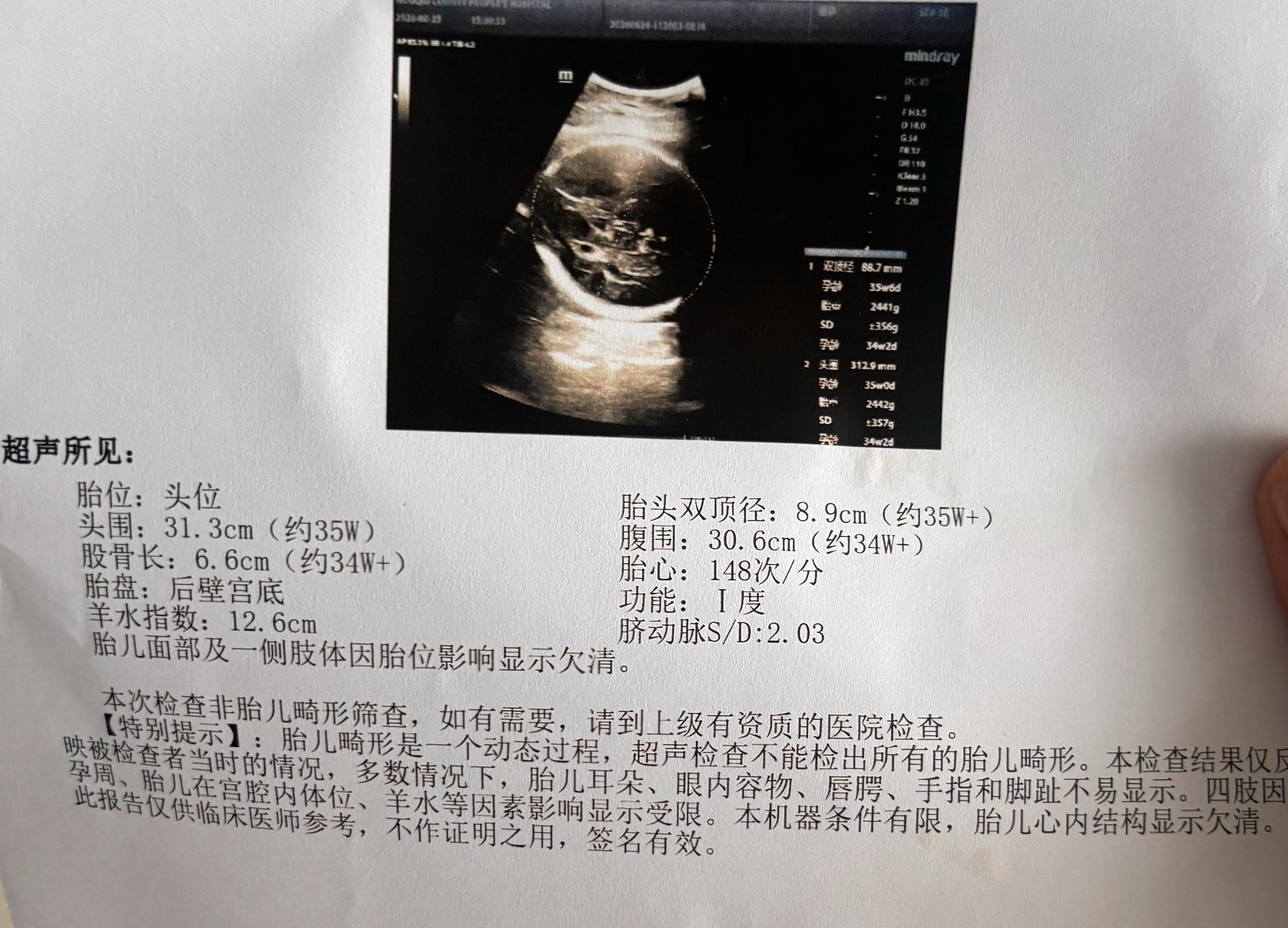 孕期产检小记✨ 控糖这段时间真的很小心，还好宝宝超给力——只长胎不长肉...