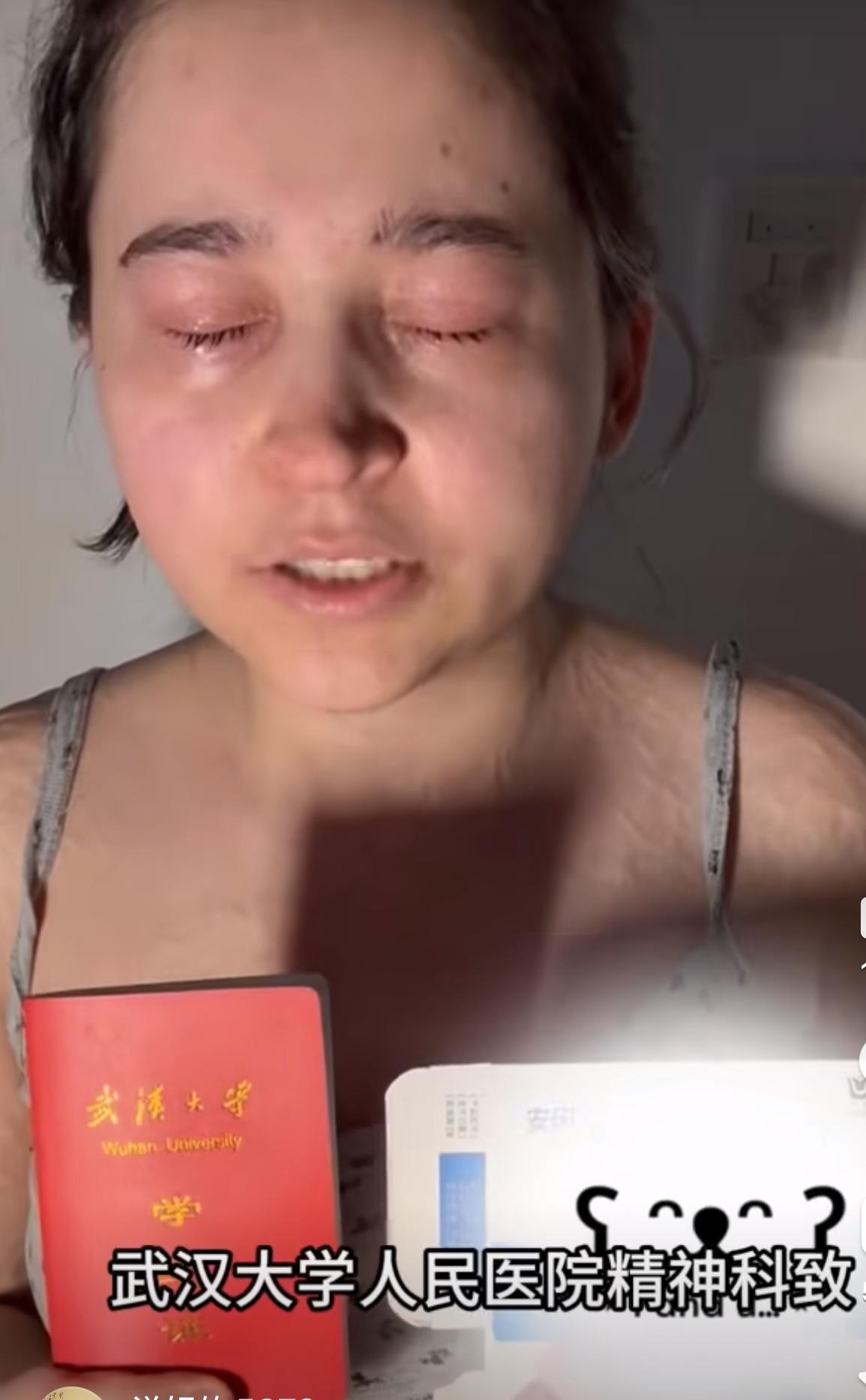 刚考入武汉大学的女孩，在武汉大学人民医院治疗失眠，用药落下六级终身伤残，目前官司