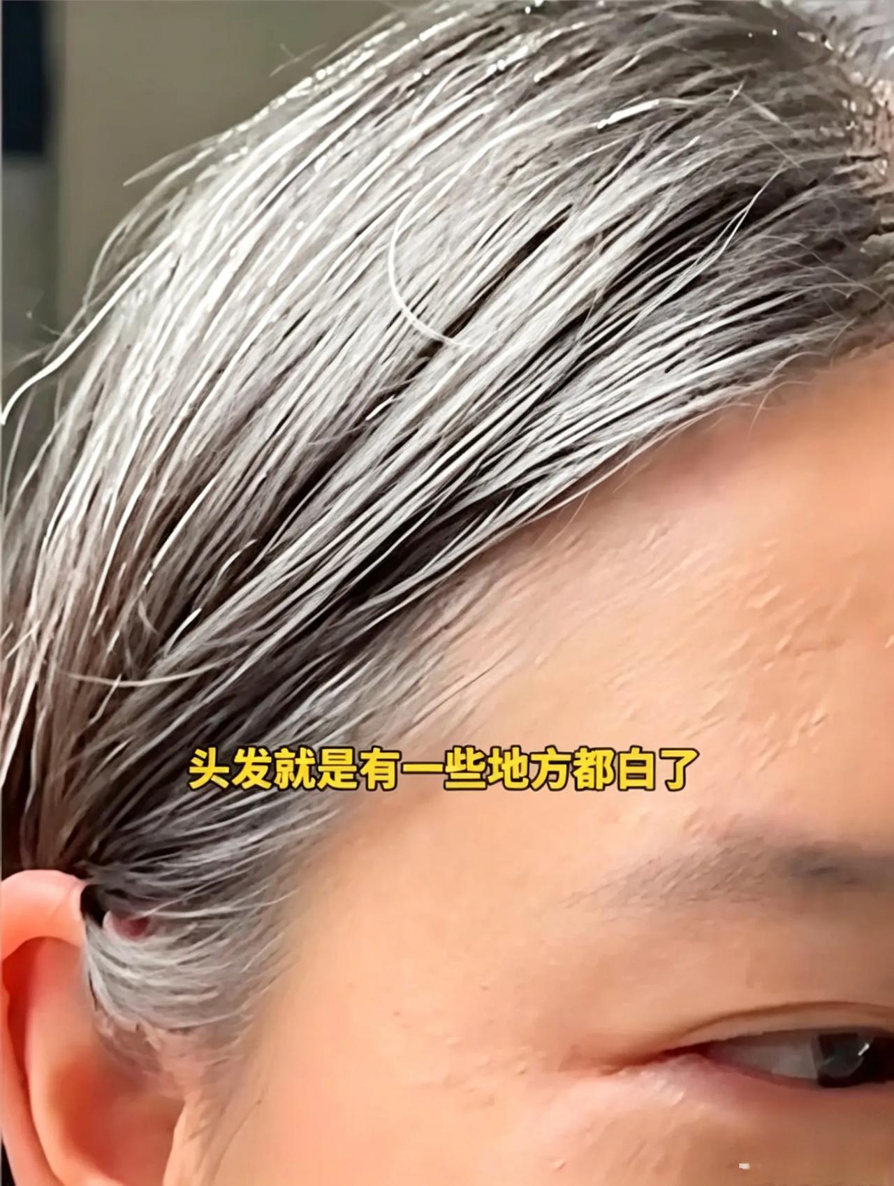 93年高三班主任熬白两鬓，她的话让全场家长泪目
 33岁，本该风华正茂的年纪。