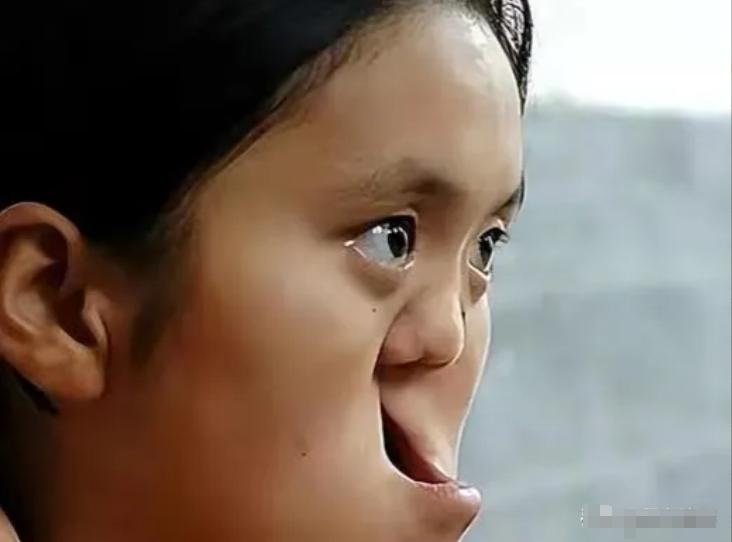1990年，陕西老农捡到一女婴，吓人的是，这个女婴没有嘴巴和鼻子。为了将女婴抚养