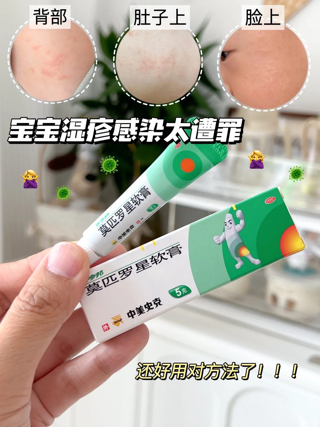 5个月！终于“战胜”了湿疹！！