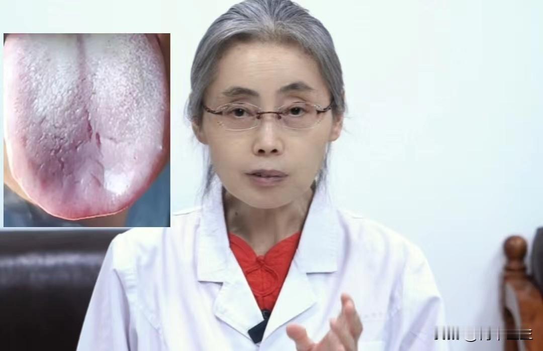 气血不足的人不要乱清热，小心身体会更虚

之前就有位患者，王先生，42岁。主诉：