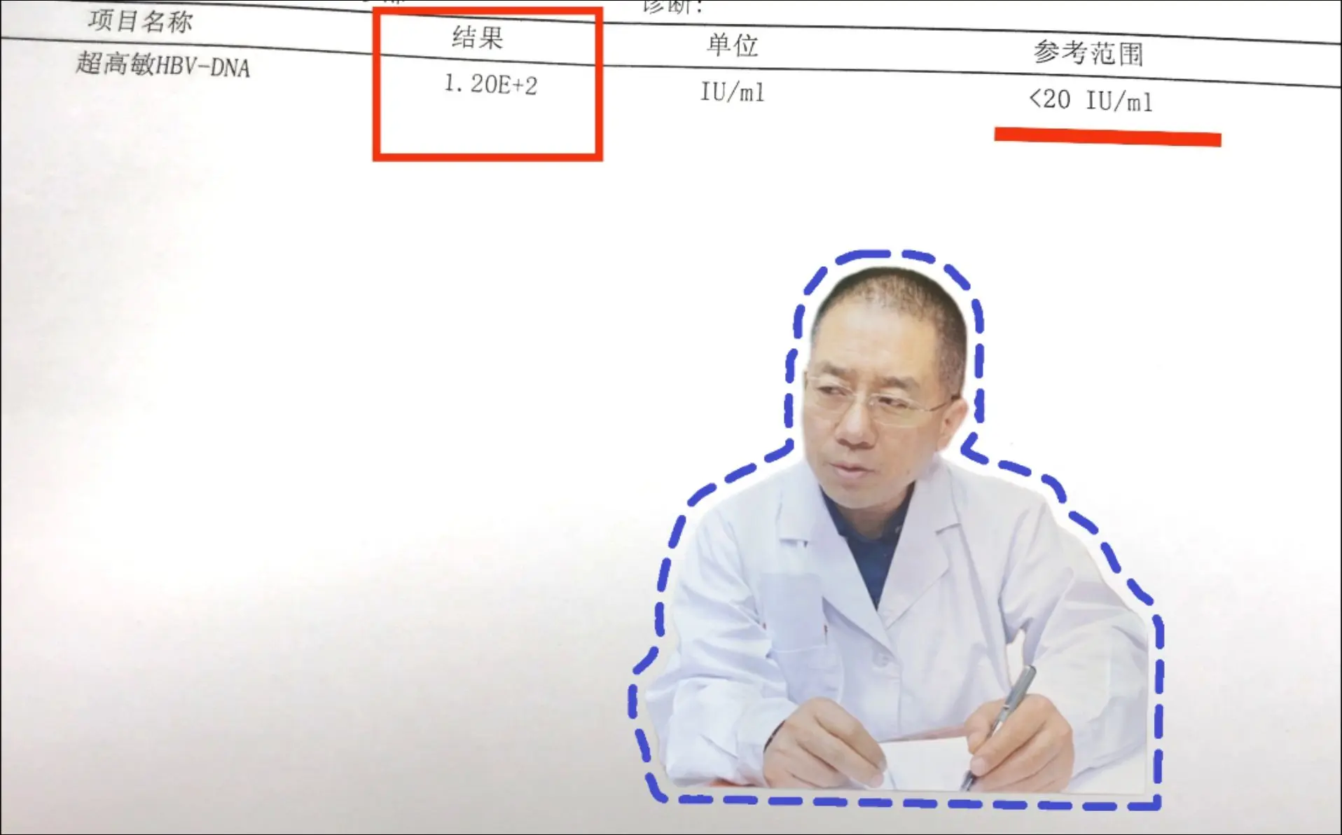 乙肝病人如果用抗病毒药1年以上，病毒量还是没有降到最低标准20以下，很...