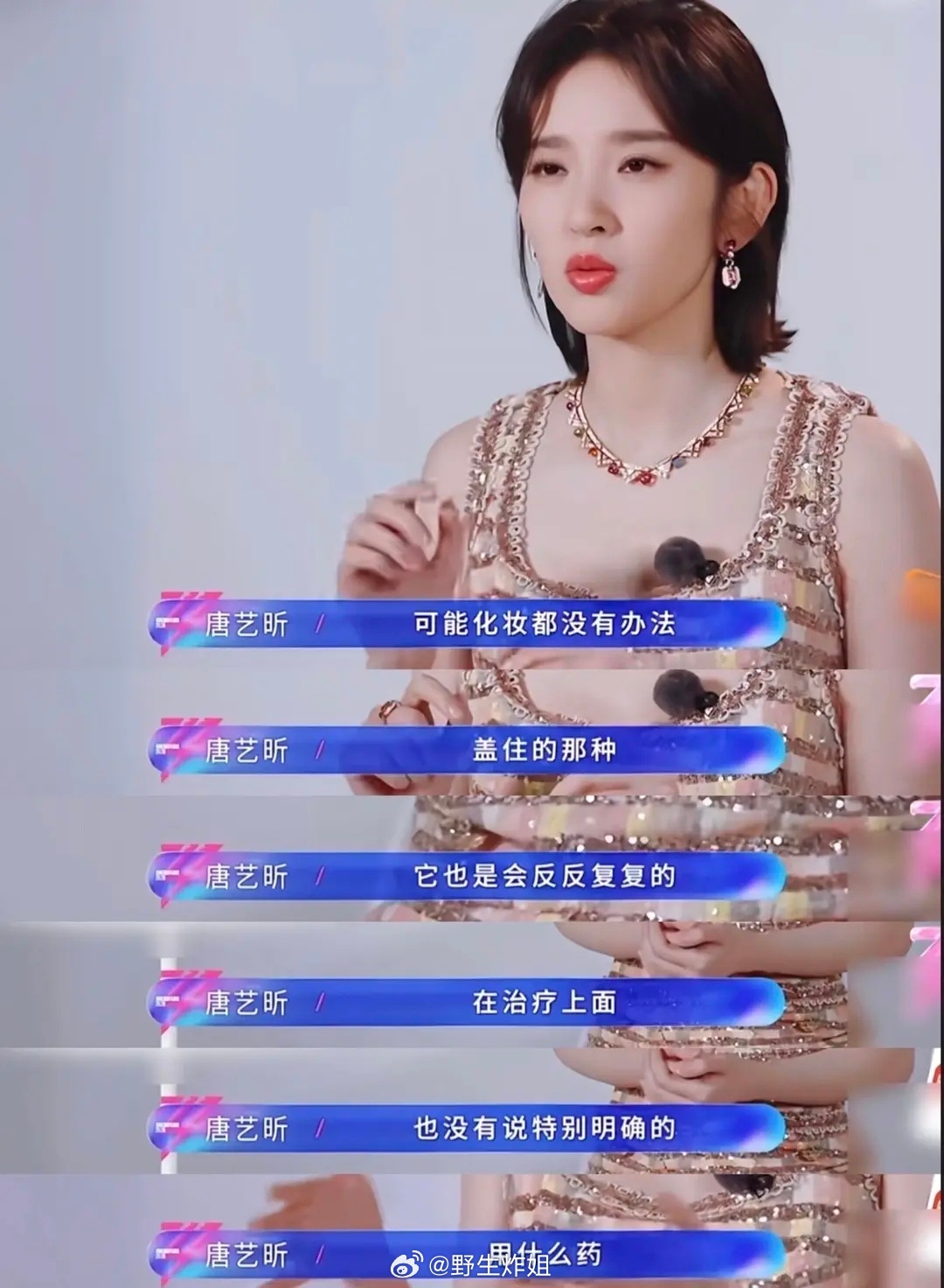 唐艺昕在浪姐说四年都没拍戏居然是因为产后反复的皮肤问题带来很大困扰浪姐今日直播暂