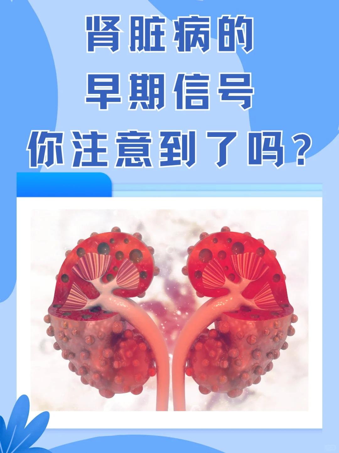 【肾脏病的早期信号，你注意到了吗？】






1.泡沫尿 尿液持久泡沫提示蛋