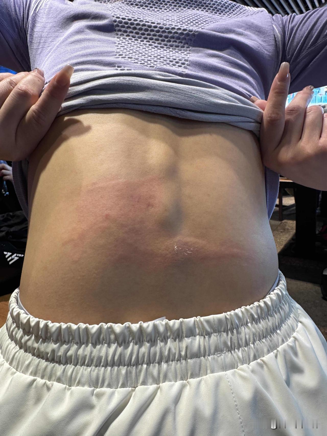 飞来横祸啊，在网边坐着都能被撞成这样😭
大年初四兴冲冲上雪道了！
滑累了在一个