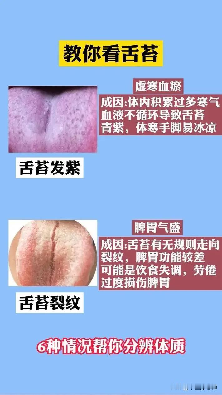 中医教你看舌苔，6种情况帮你分辨体质#健康##舌象#