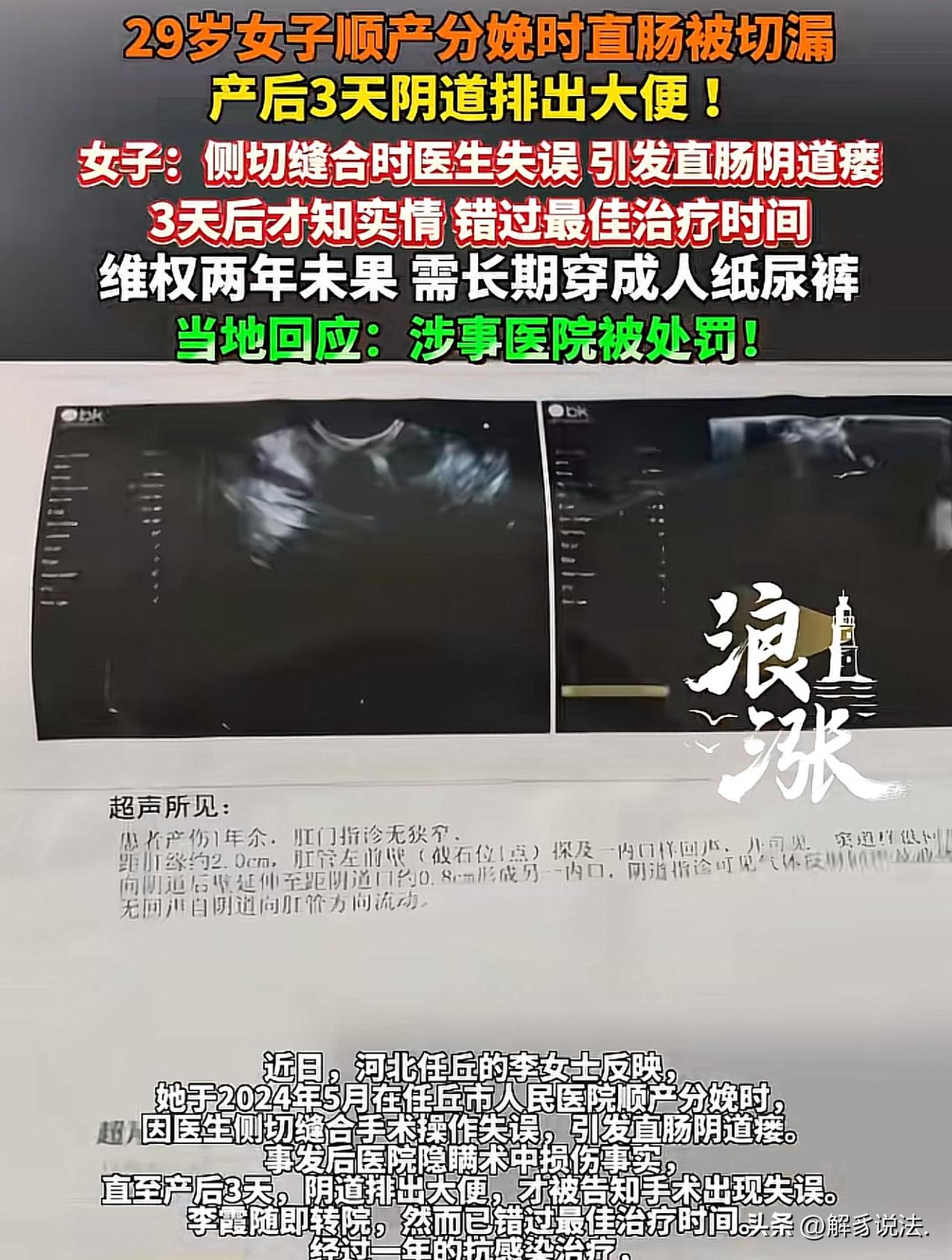 “太坑人了”河北任丘，29女子岁在某医院顺产生娃，3天后，突然在阴道里排出大便，
