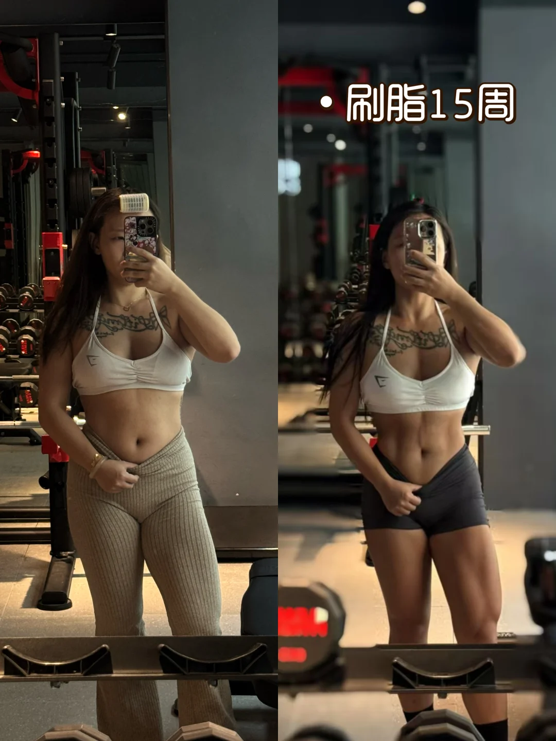 🇭🇰新年刷脂前后 人都变轻盈了