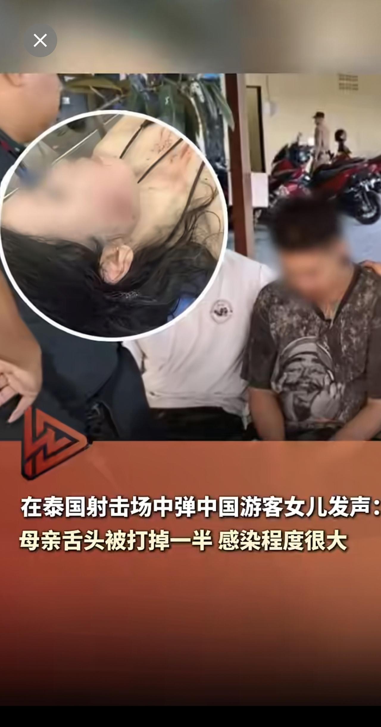 在泰国射击场中弹中国游客女儿发声：母亲舌头被打掉一半，伤口感染程度很大。射击