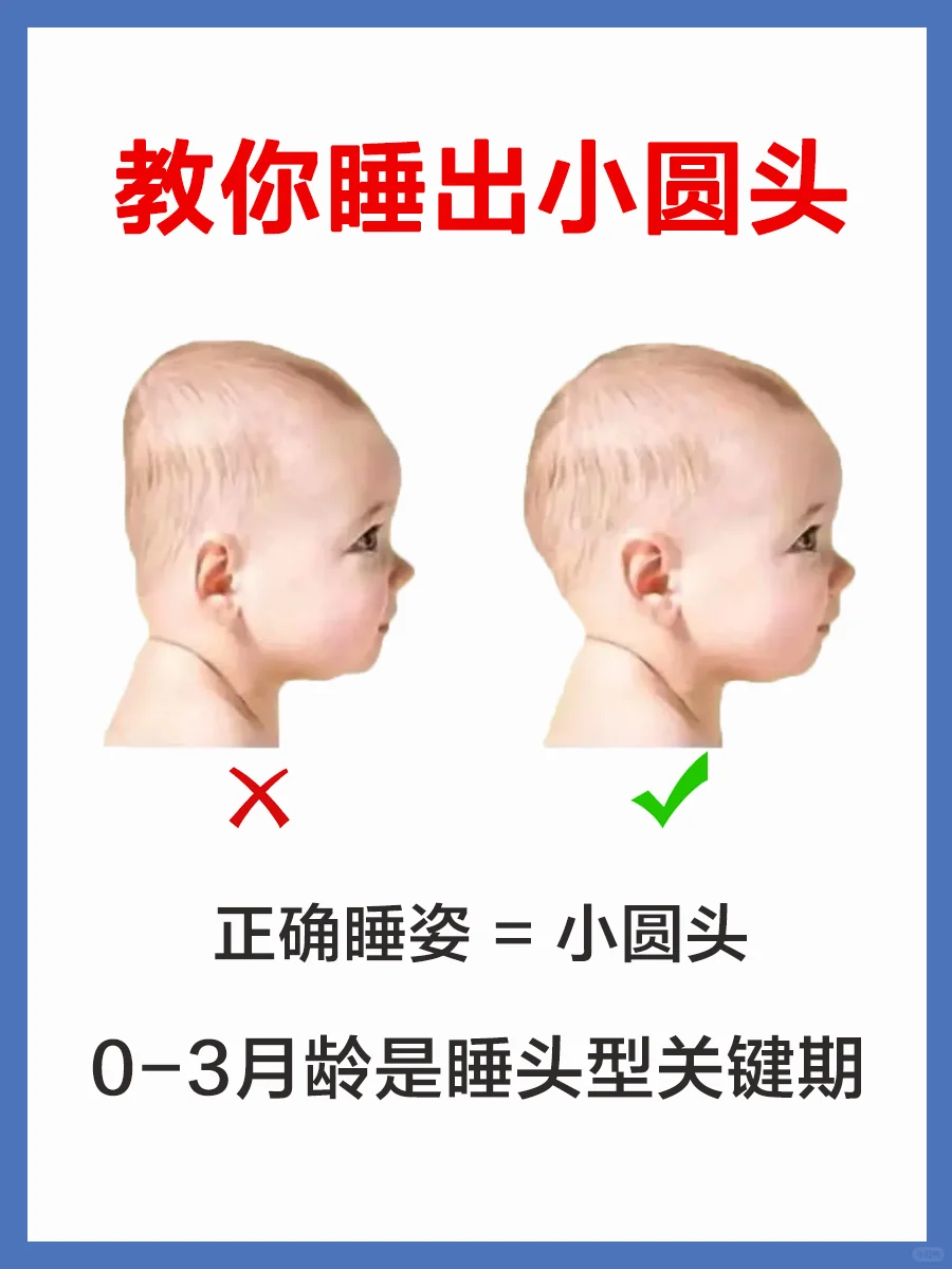 这样做一招睡出小圆头✅附头型纠正方法❗️