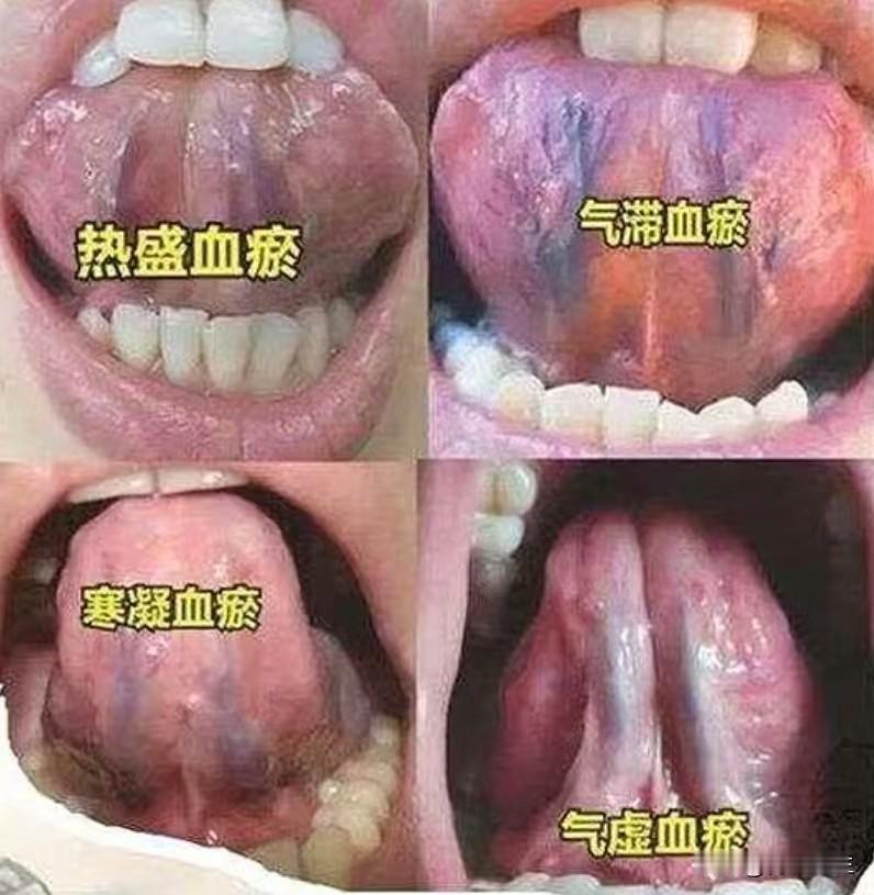 下午好！今天周日休息，给大家专门看舌！你发舌头我来分析，全程不收费！发多少看多少