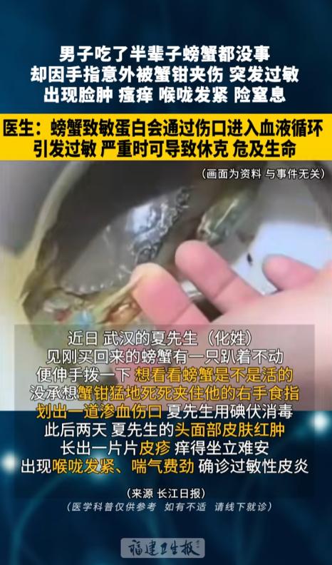 “万万没想到！”7月25日报道，湖北武汉，一男子买了螃蟹回家，发现有一只不动弹了