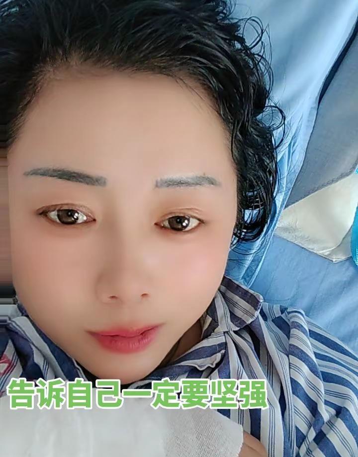 今天是手术的第三天，一开始是发烧37度八，吃了退烧药后烧退了现在又不停的流虚汗，