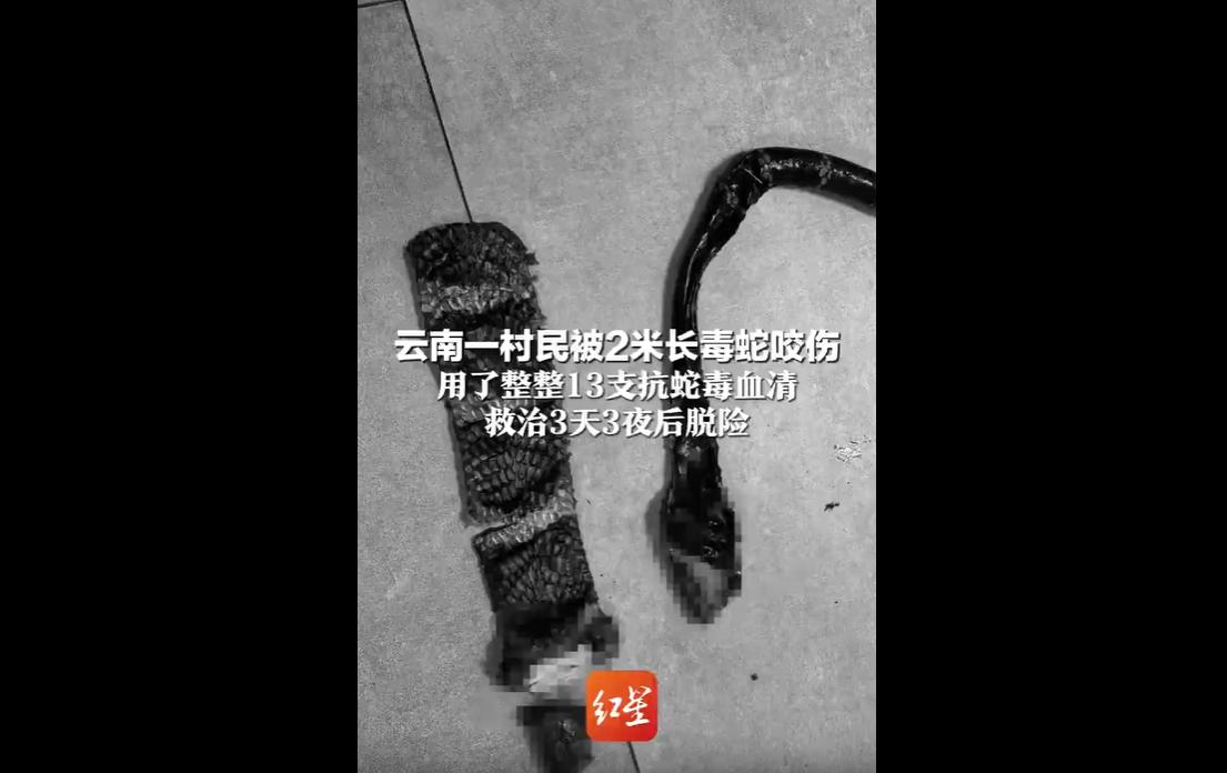 近日，云南昭通一名村民在田间劳作时，不幸被一条两米长的眼镜王蛇咬伤。
事发后，村
