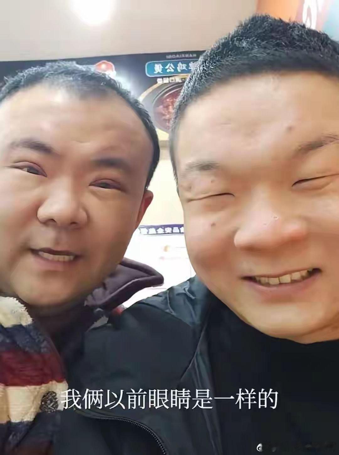 陪弟弟割双眼皮结果自己先割上了这是真“眯缝眼”啊，是我见过的眼睛最小的了