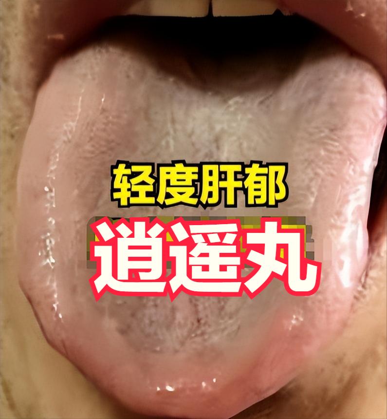 男科问题 9 成都不是肾虚，是肝气堵住了！4 个中成药，对症一用，帮你找回男人底