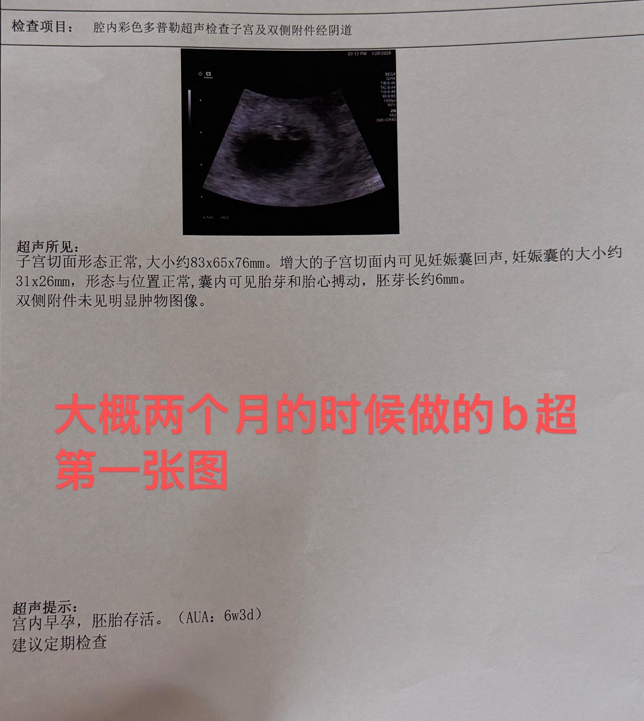 问了豆包 她不说是什么，嘴严得很，还是请我这些姐妹们帮我看看，我应该准...