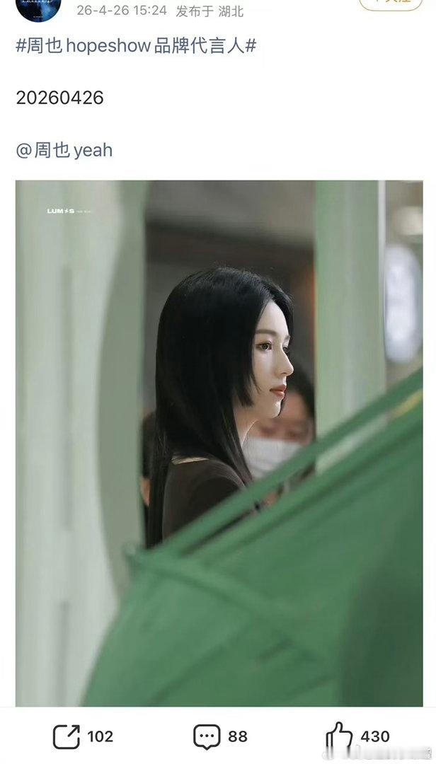 周也下巴后缩是不是硬伤