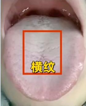 今天周末休息[鼓掌][鼓掌][鼓掌]继续给大家看舌，不管有多少人，我都会一对一详