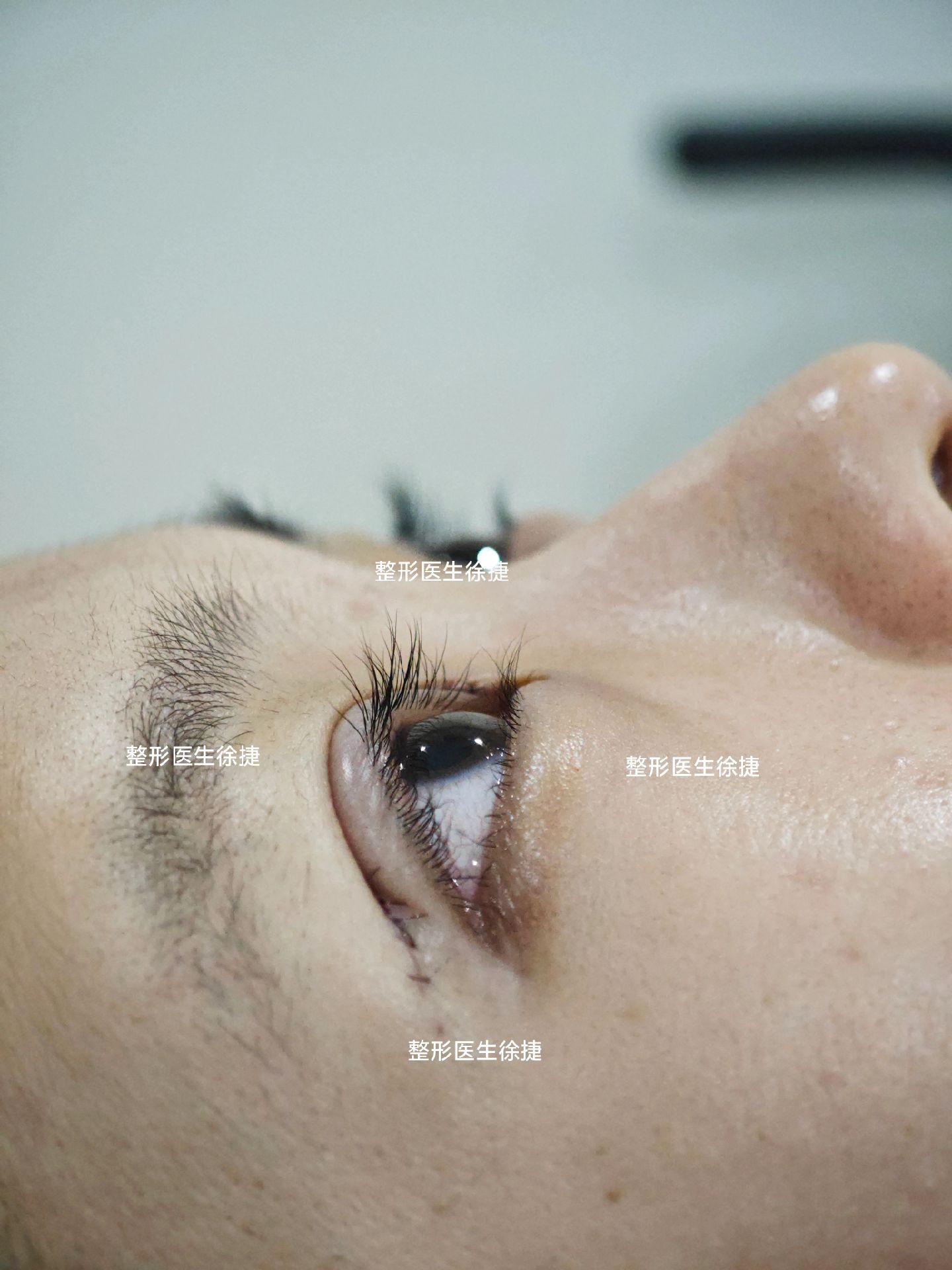 妹妹蒜皮✅。今天是双胞胎，上午姐姐 下午妹妹✅