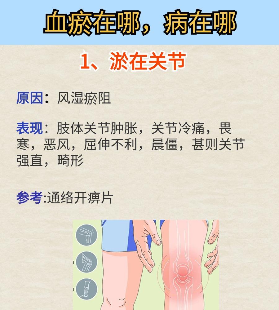 血瘀在哪，病在哪，中医教你瘀血的调理方法大全