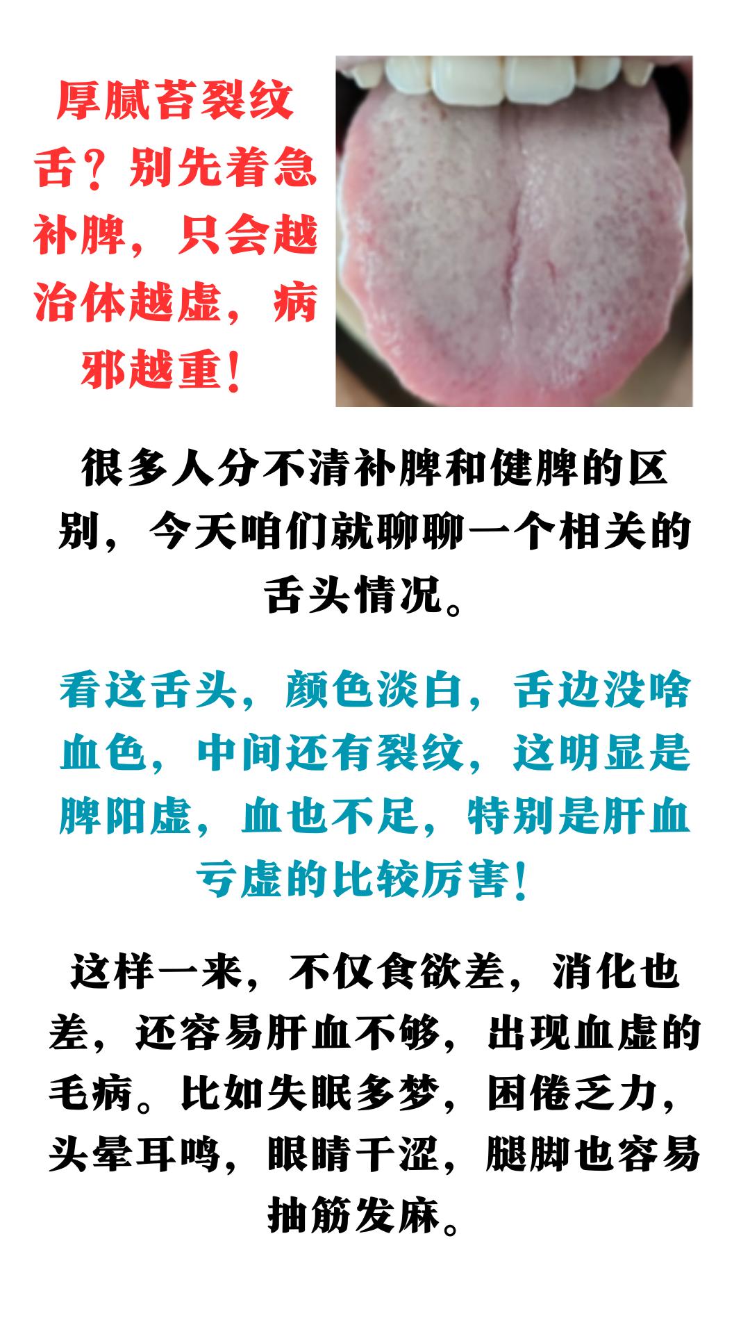 厚腻苔裂纹舌？别先着急补脾，只会越治体越虚，病邪越重！#健康科普##中药##中医