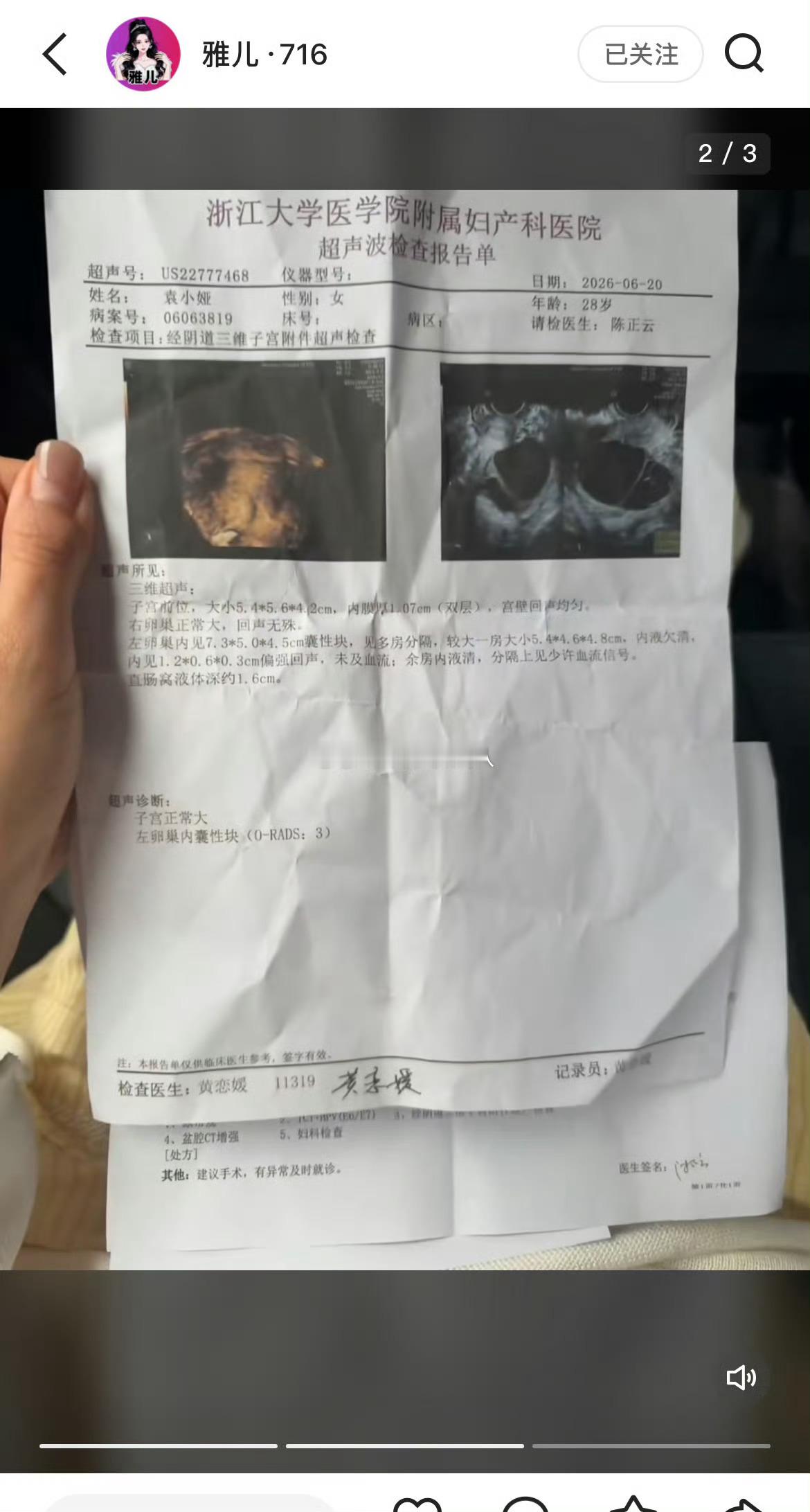 716雅儿生病了要请假一段时间，囊肿要做手术。 