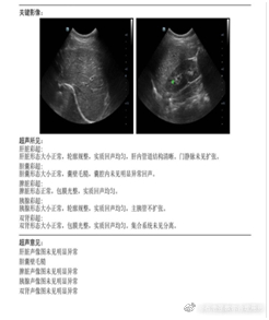  甲状腺双侧叶囊性结节ti-rads2类的病人日常要注意什么？主诉：详见刚出的体