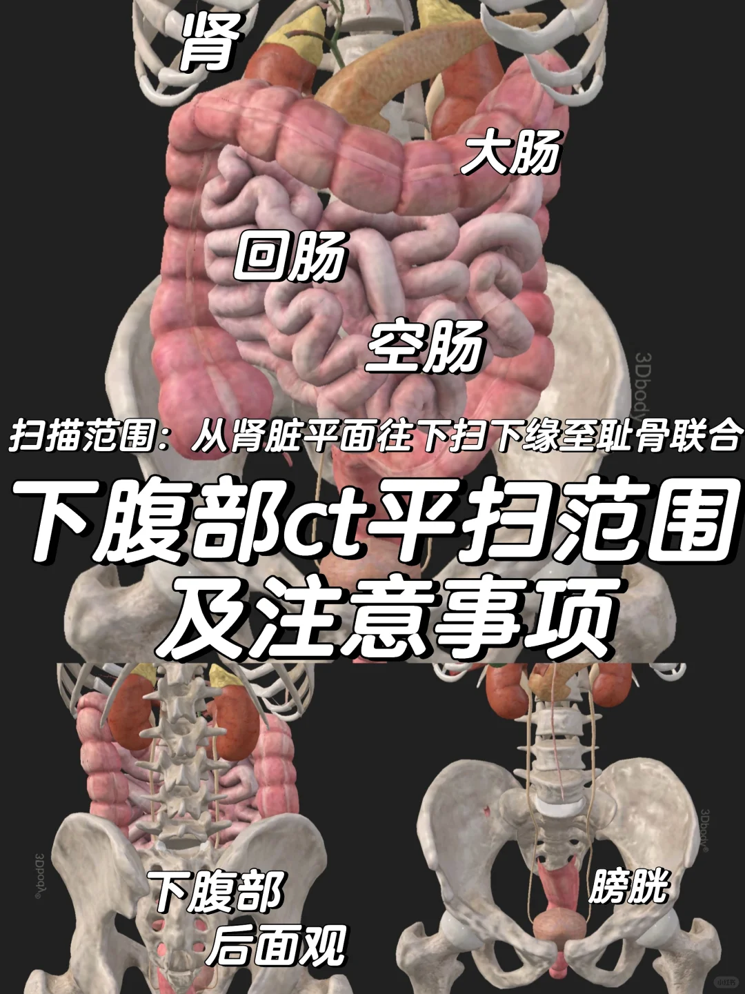 医学生笔记-下腹部ct平扫