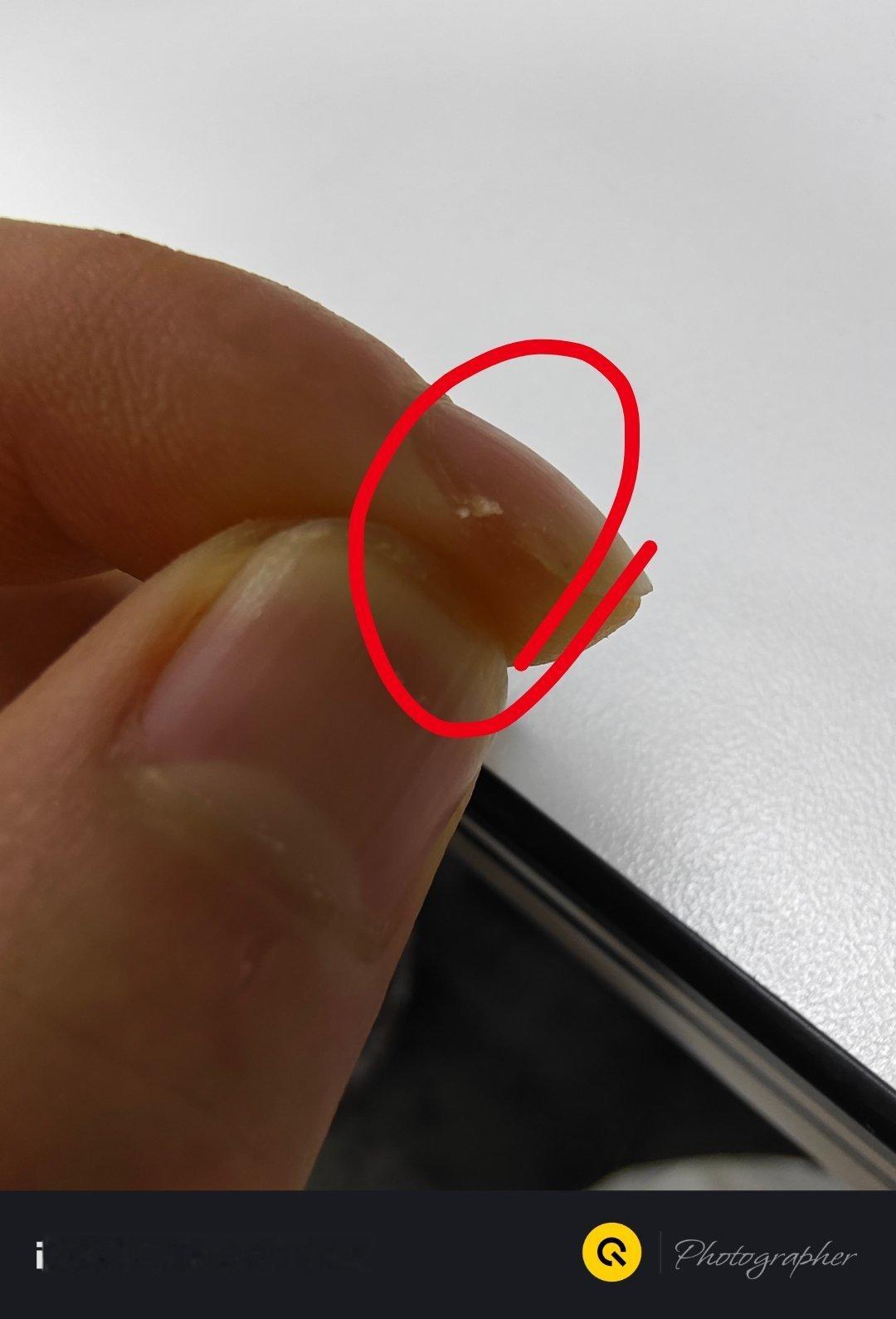 这种情况你们怎么处理？ ​​​