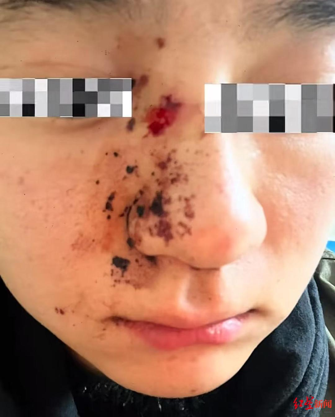 【#男子称被狗扑倒后因质问不牵绳遭殴打#，警方曾回应确实未牵绳，目前该案还在调查