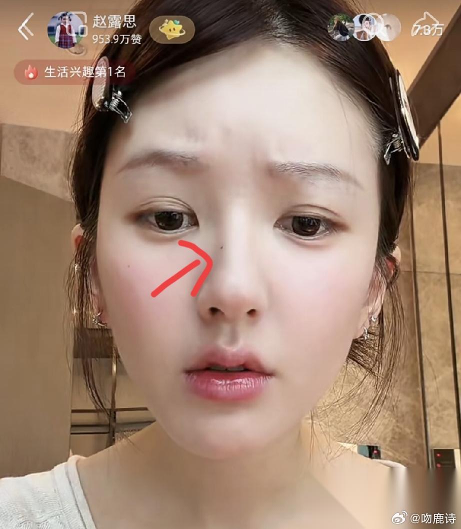 发现了没有 赵露思有一个点很特别 仔细看看直播的照片，她鼻子上的那颗痣真的太显眼