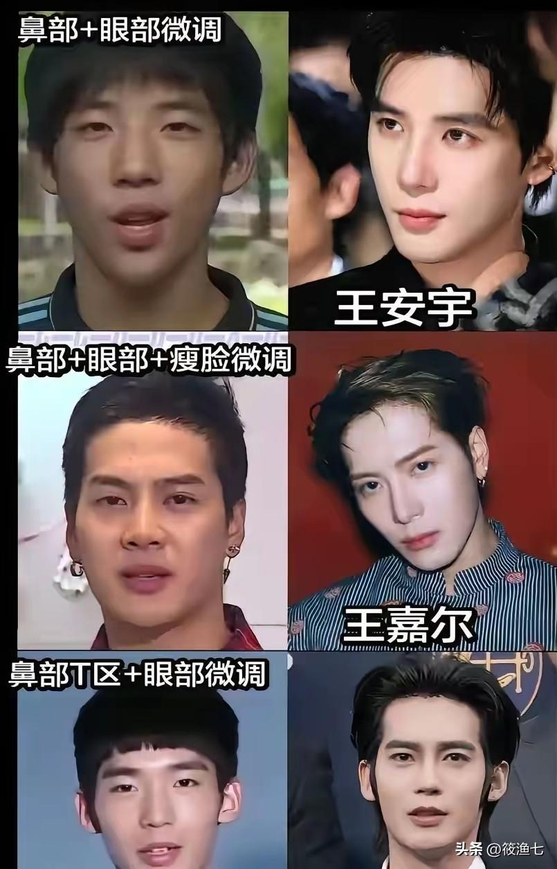 以前叫:整容
现在叫:微调，医美
香港的老牌明星几乎全部纯天然:梁朝伟，刘德华，