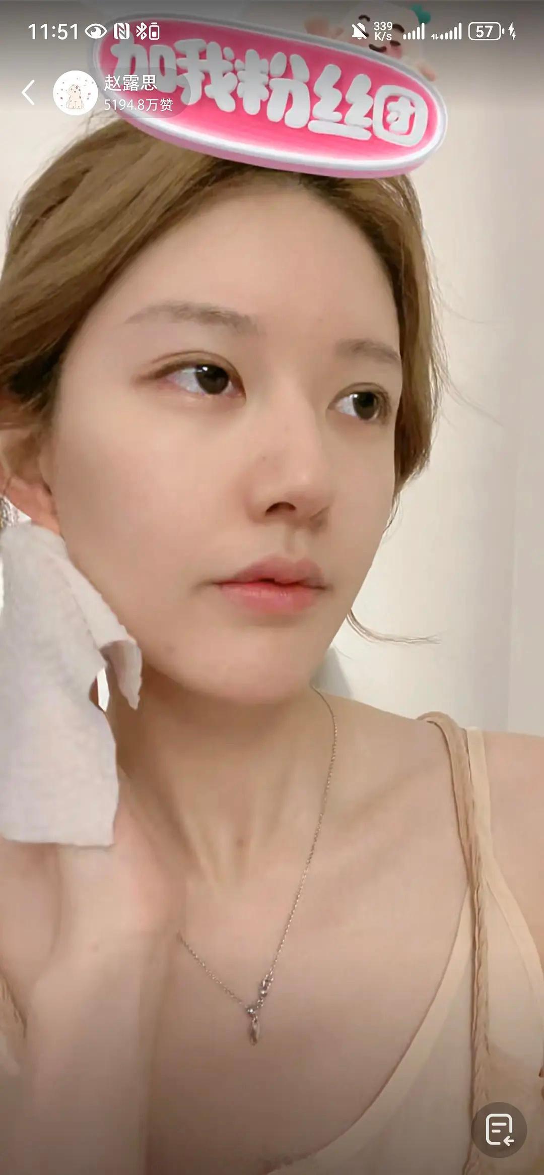 赵露思直播 卸妆后的纯素颜，来审判下状态如何？ ​​​