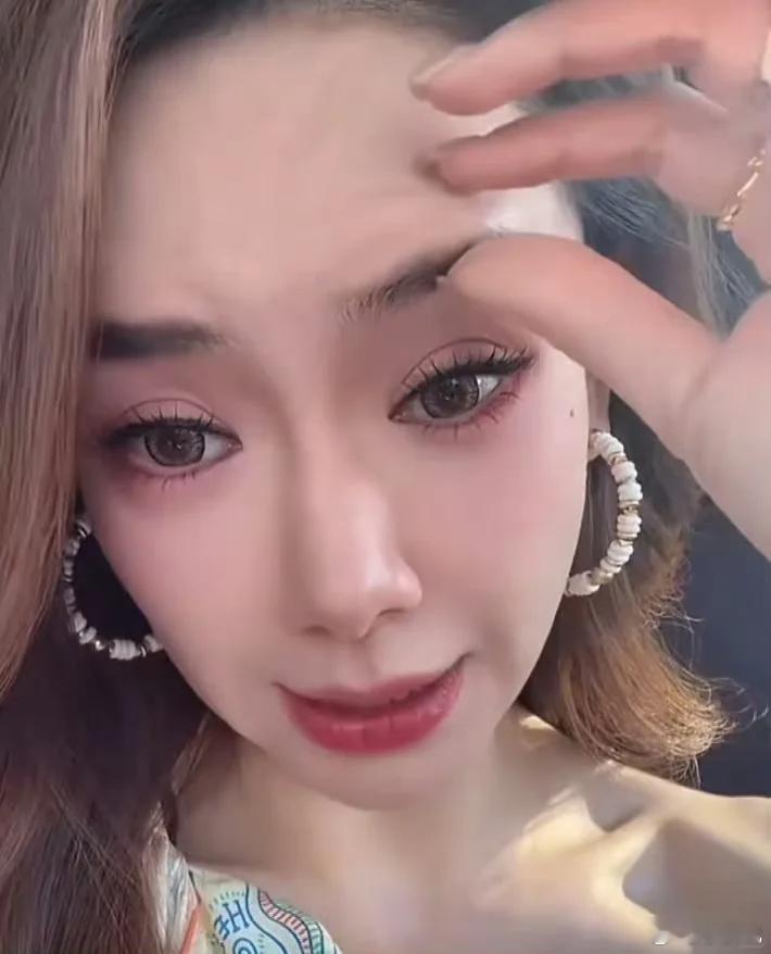 戚薇回应“吊梢眼” 大方承认是肉毒素打多了。观众都看得出做项目情况下，还遮遮掩掩