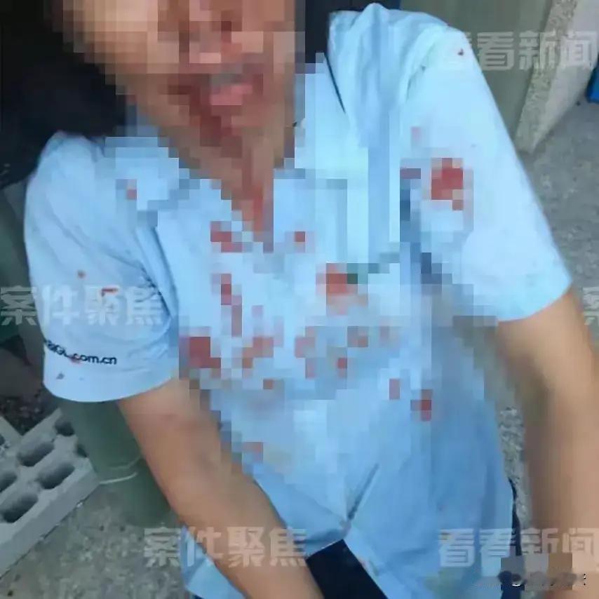 上海，一外甥带5人上门，对舅舅进行围殴，舅妈激愤之下，拿起一瓶强腐蚀性液体，直接