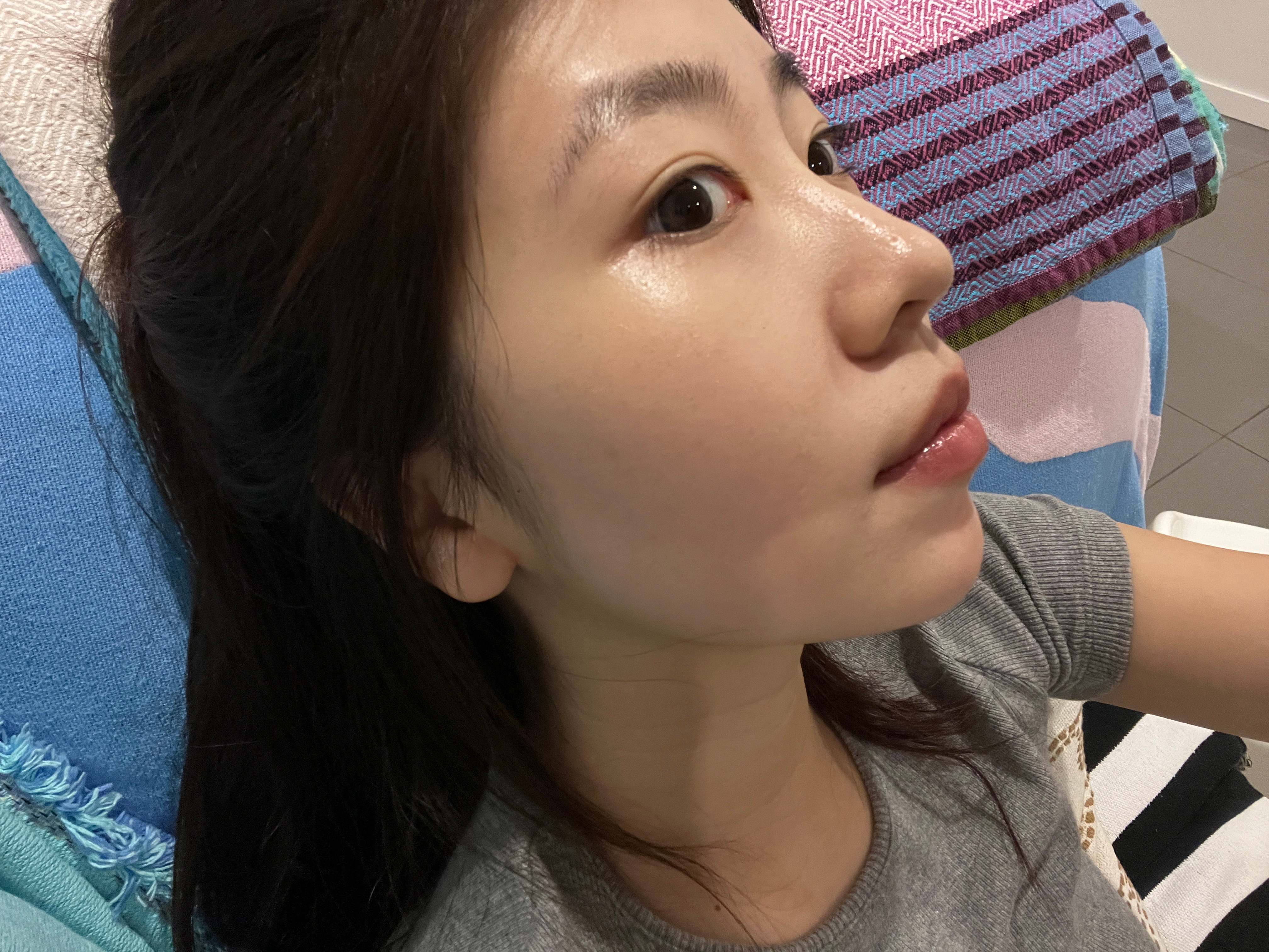 最近素颜状态很好 但是想去韩国打个鼻基底[白眼] ​​​