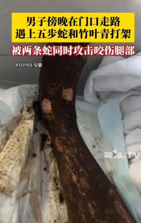 [微风]电视剧都不敢这么演！安徽，一男子傍晚散步时，偶遇竹叶青和五步蛇打架，不料