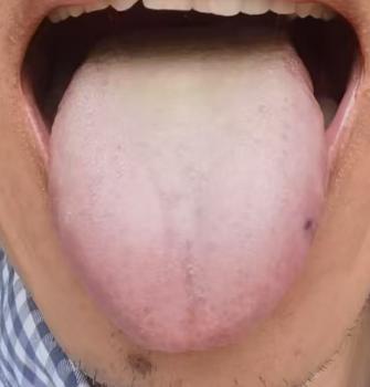 中年体虚状态不佳，中医补血活血、通络养筋是关键







有不少男同志因为各