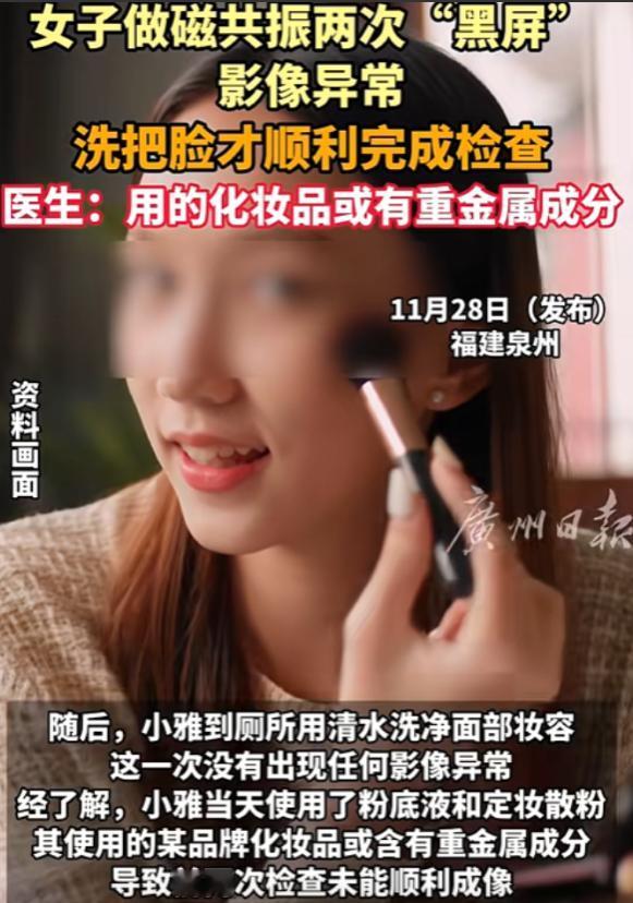 解释不清了！福建一29岁女生头晕，去医院做头颅磁共振。不料，连续2次扫描，都因面