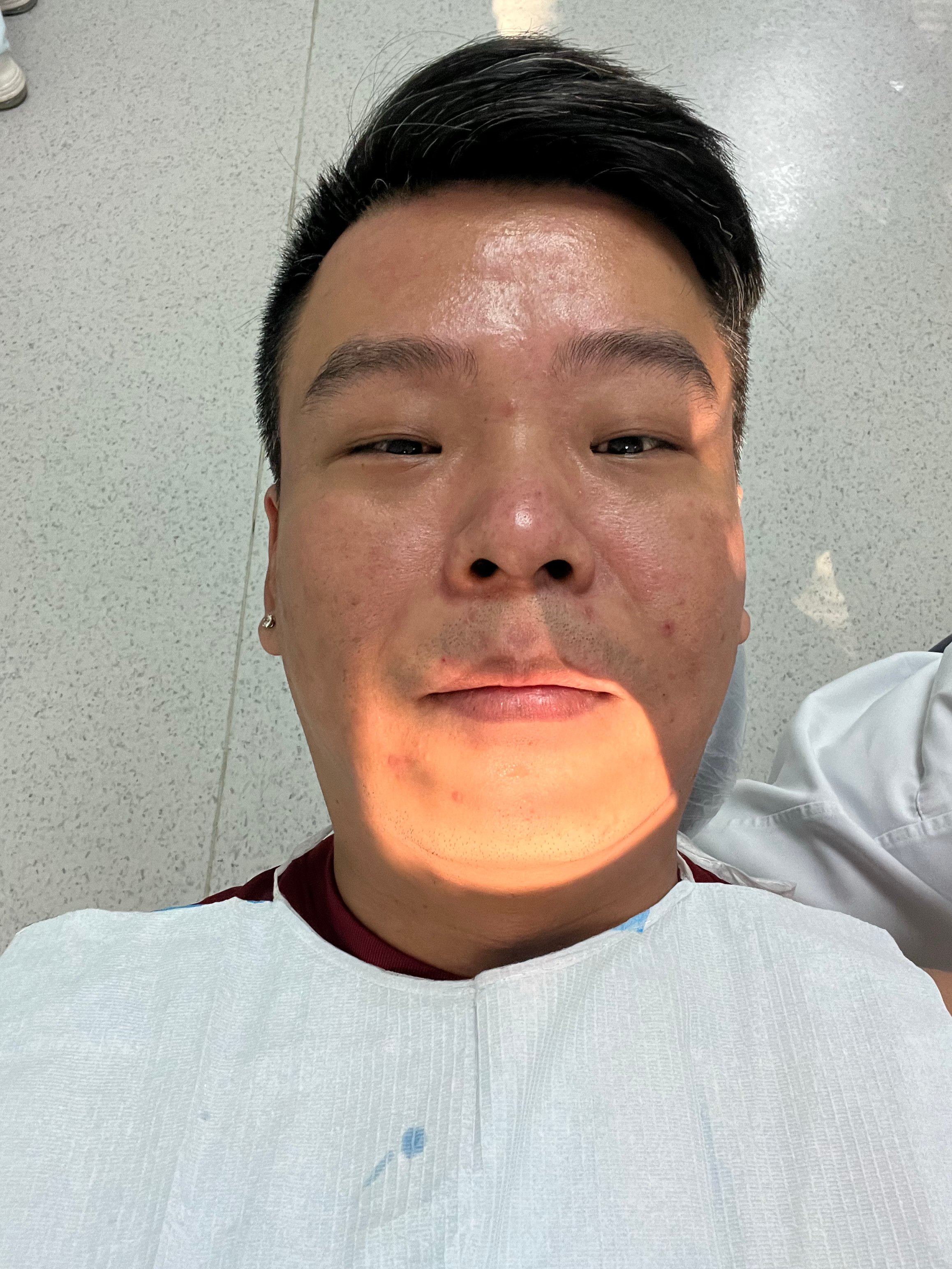 世俱杯之前，这颗智齿就开始犯病[允悲]硬是生熬了一个半月，终于忙完了！拔完一看，