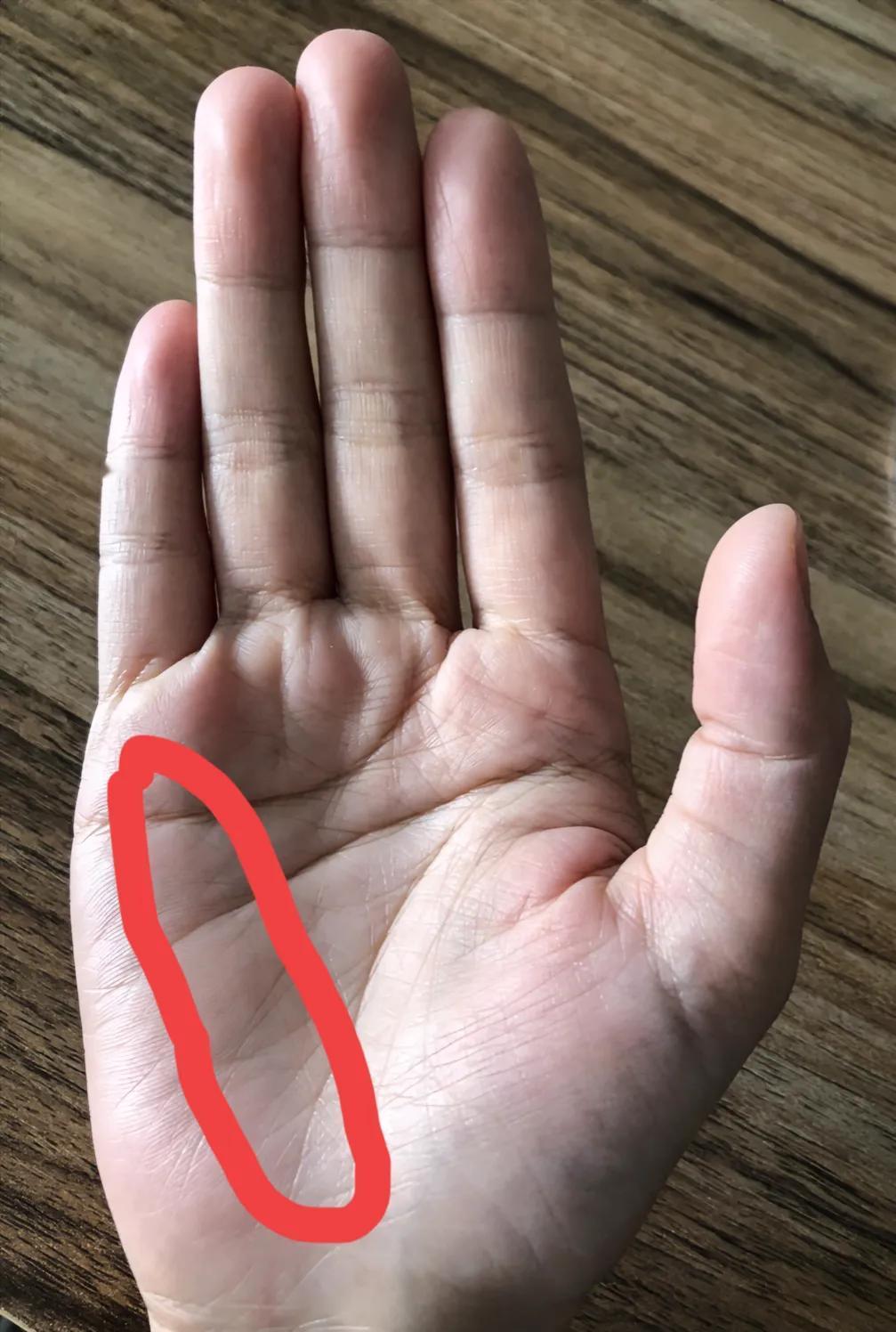 手纹还会变的，不知不觉又多了一条纹出来，这没什么事吧，有会看手纹的吗？#中医是否