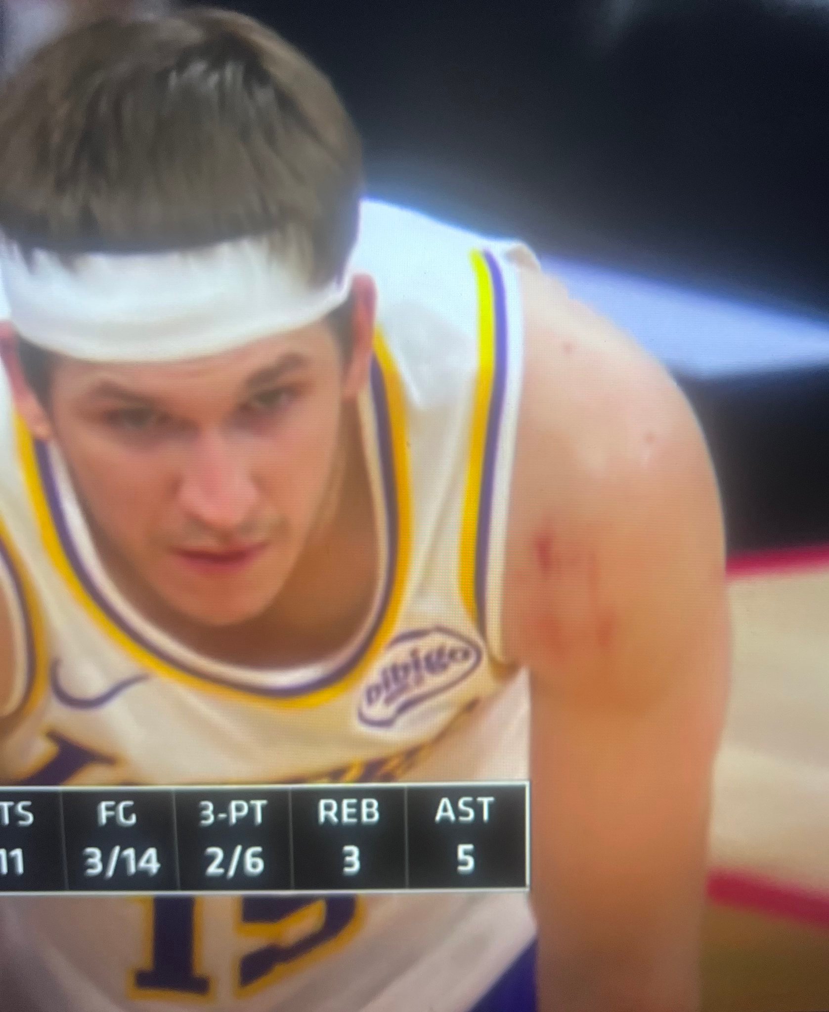 里夫斯今天也被熊抓了。洛杉矶湖人湖人vs76人