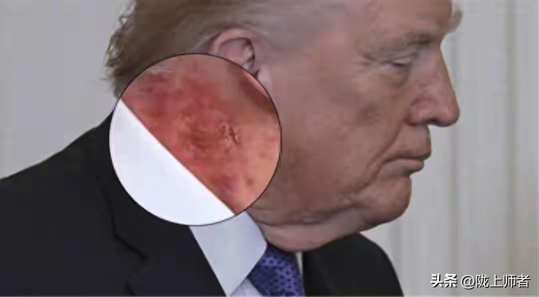 我个人认为这次美国帮以色列打伊朗将要断送掉美国的国运。以前的美国总统雷厉风行，志