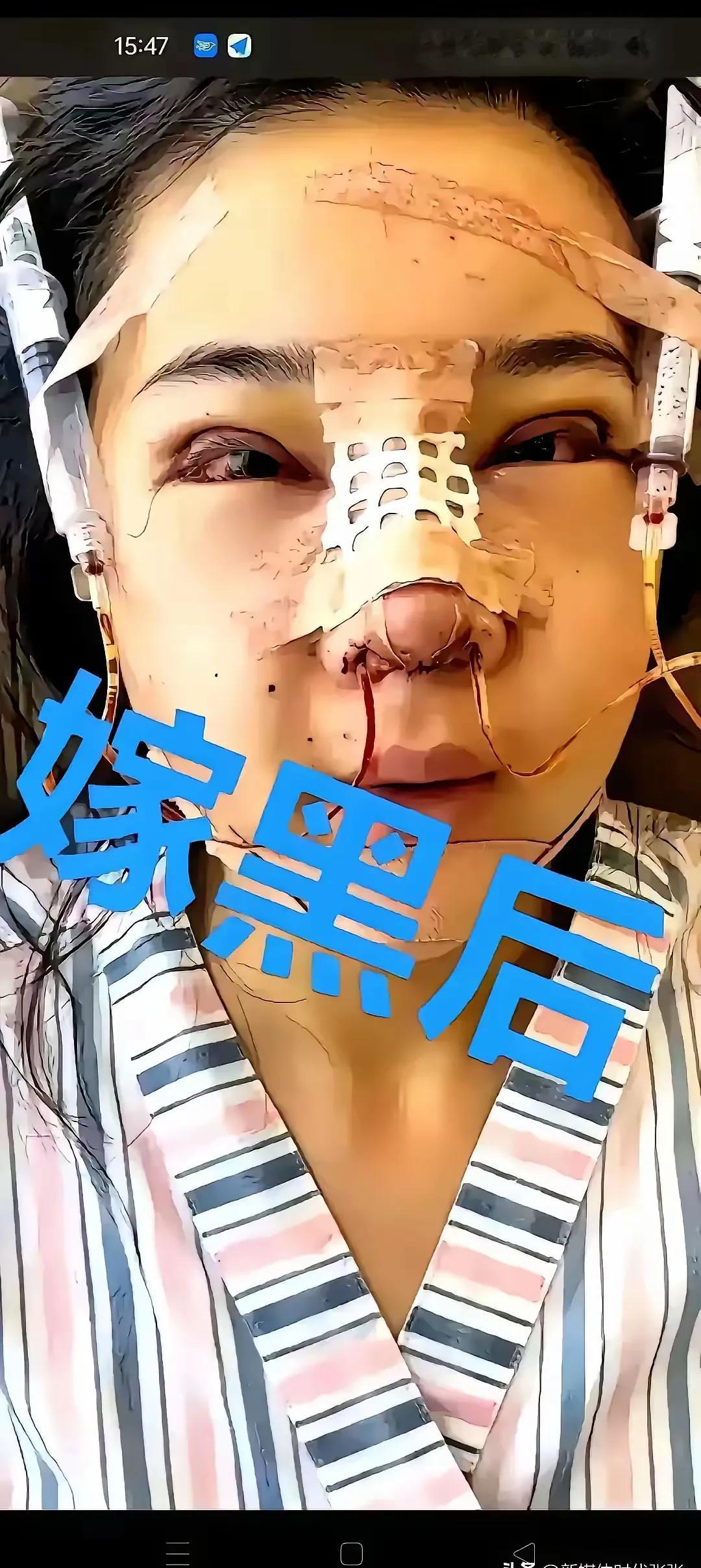 中国姑娘远嫁非洲黑人都得到了什么一一
最近，看了网上很多中国美女远嫁非洲黑人的小