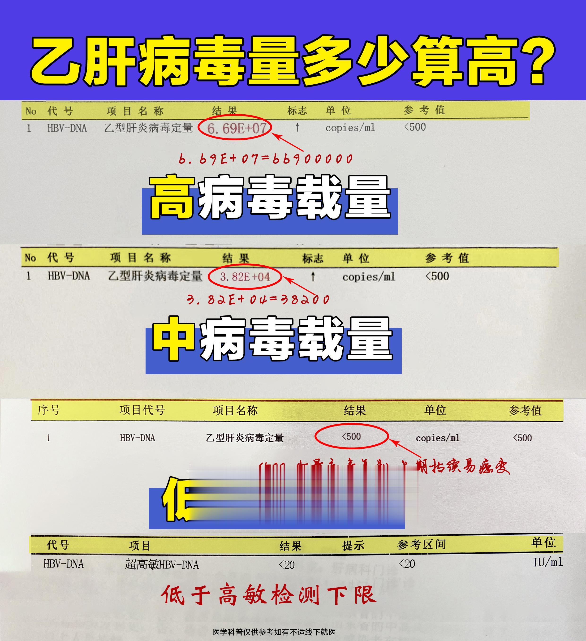 病毒量的高度代表着病毒复制的活跃程度和传染性的强弱，临床上高病毒载量的...
