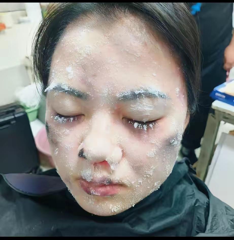 广东揭阳这事儿，再听后续，心里更不是滋味。

几个大老爷们这么小心眼，看小姑娘进